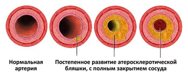 Простых и надёжных способов повысить потенцию без таблеток